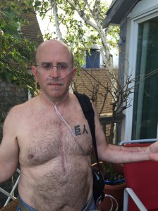 with scars on right forearm and down my chest from bypass and with oxygen...